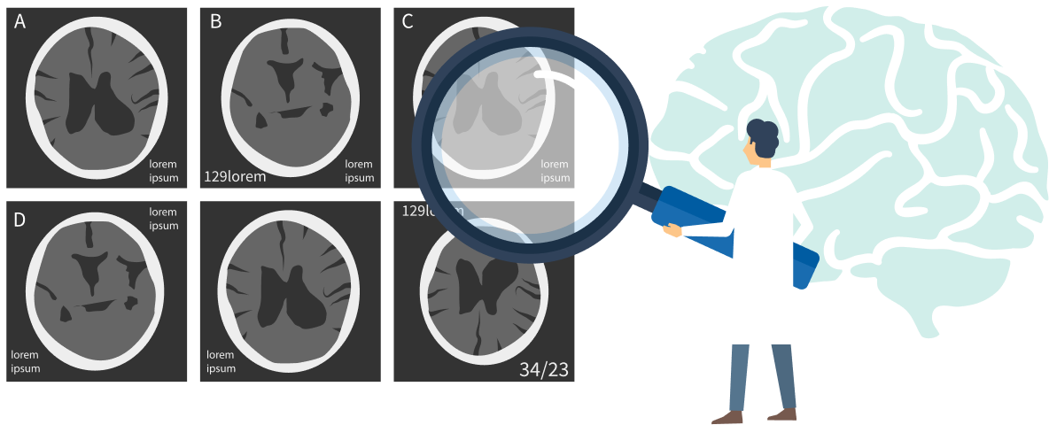 脳疾患の怖さ イメージ